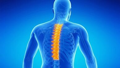 Cos'è l'osteocondrosi della colonna lombare